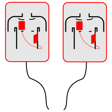 AED-UCC_PADS